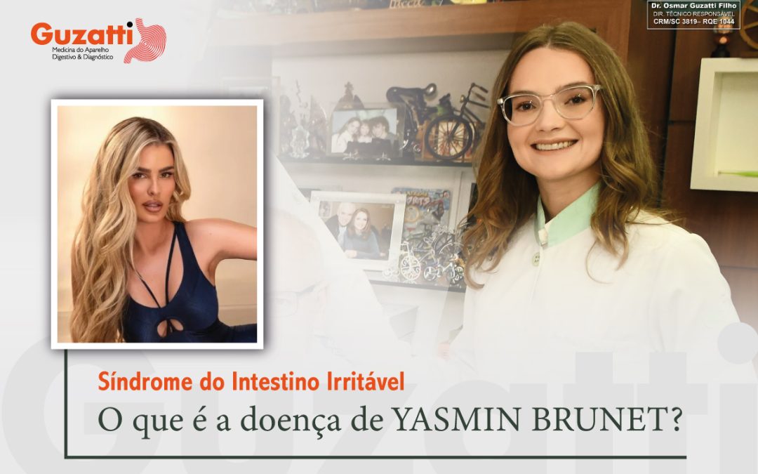 Sín­dro­me do Intes­ti­no Irri­tá­vel: O que é a doen­ça de YASMIN BRUNET?