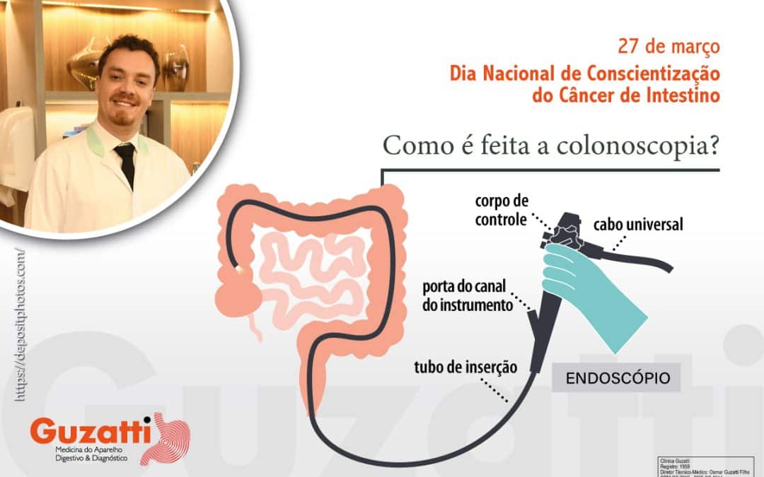 Como é fei­ta a colonoscopia?